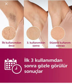 Phılıps Şarjlı ve elektrikli Sınırsız Atışlı Lazer Epilasyon Cihazı 5 başlık