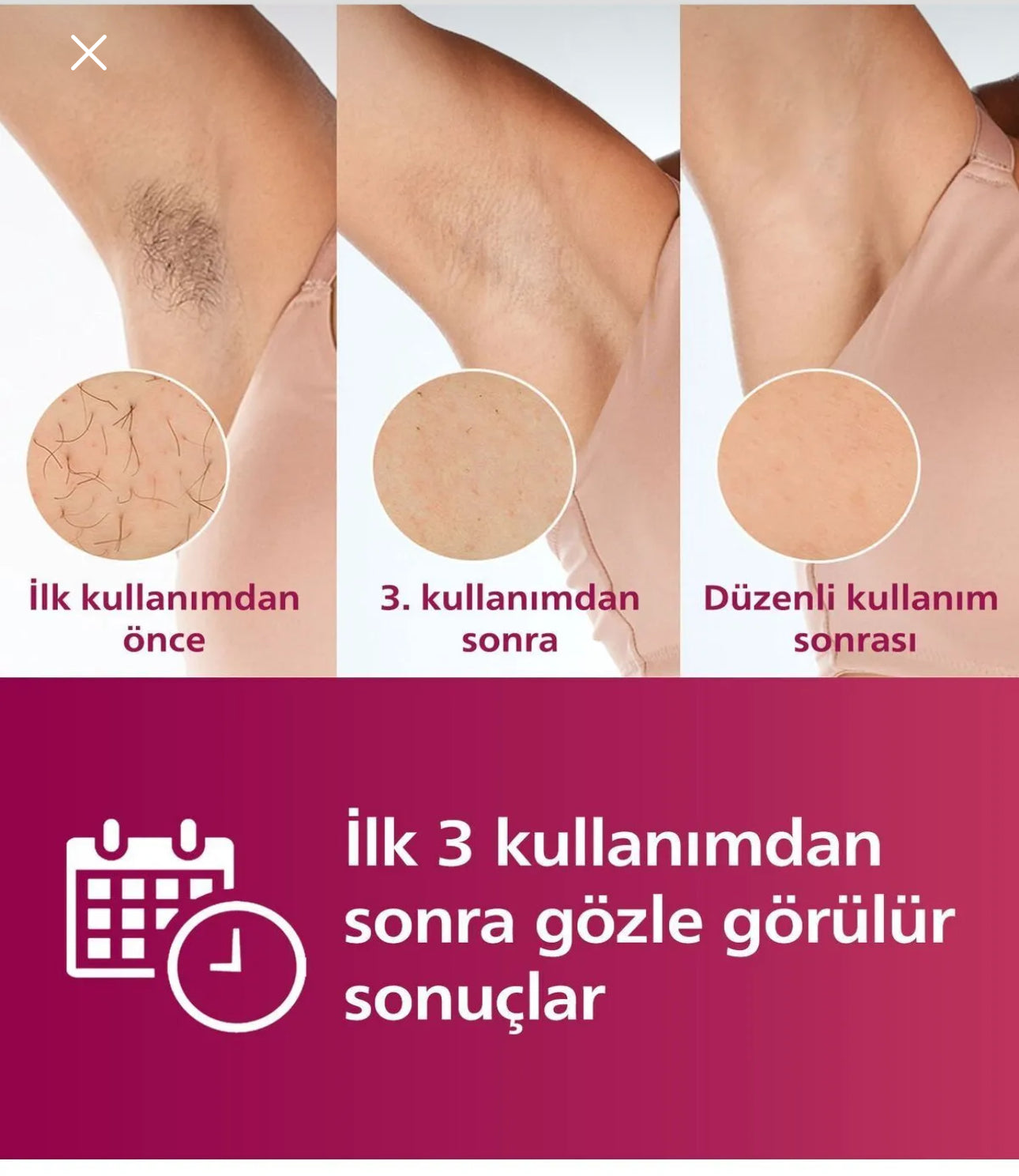 Phılıps Şarjlı ve elektrikli Sınırsız Atışlı Lazer Epilasyon Cihazı 5 başlık